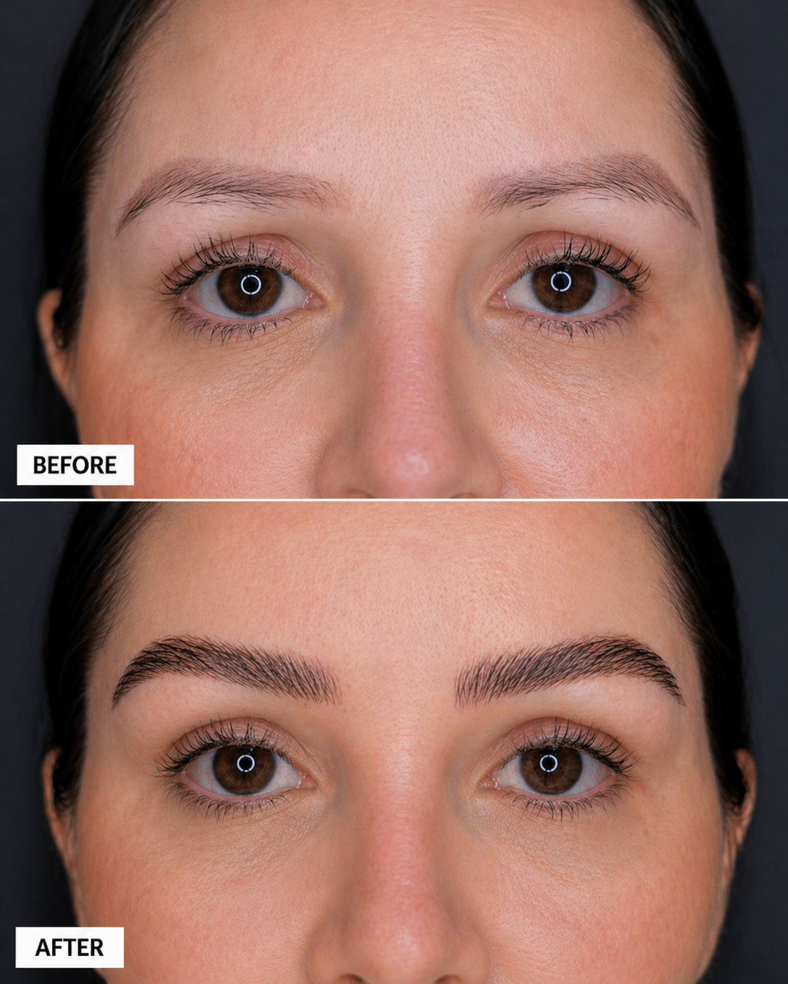 Before & After — Brow Restoration
