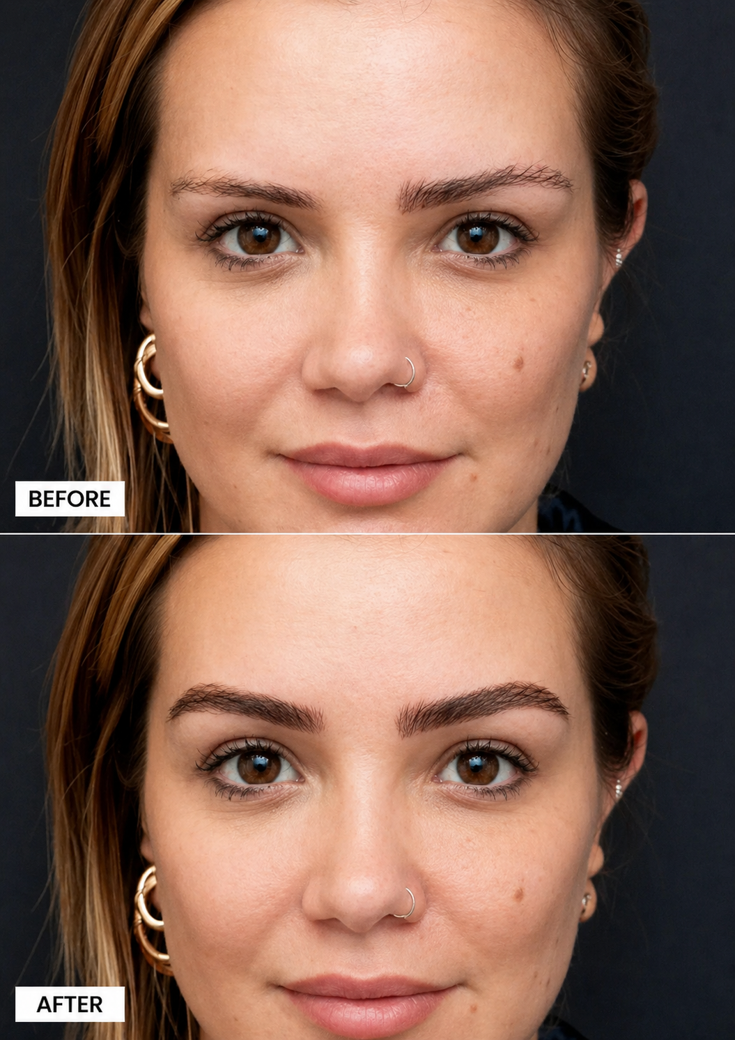 Before & After — Full Face