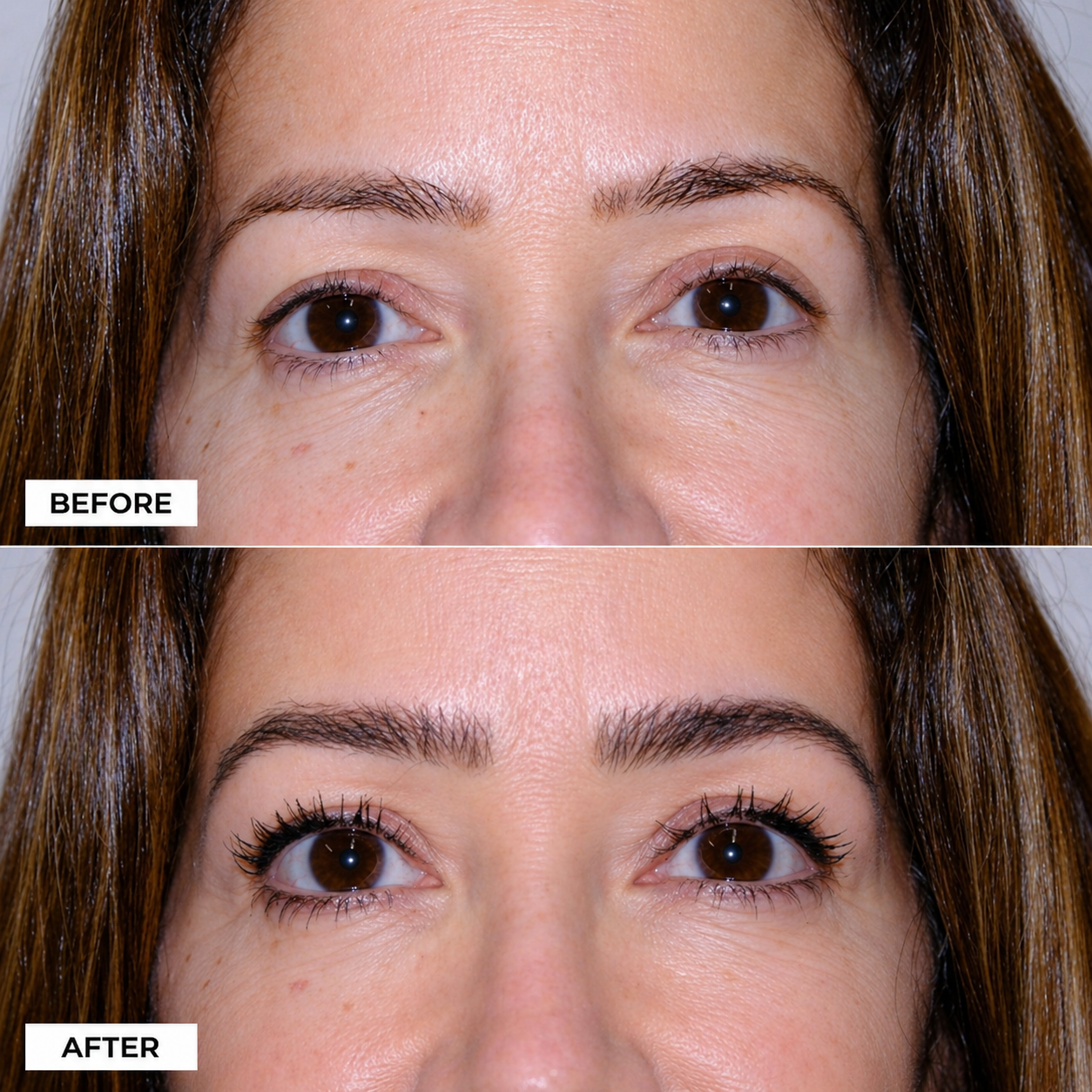 Before & After — Brow Regrowth