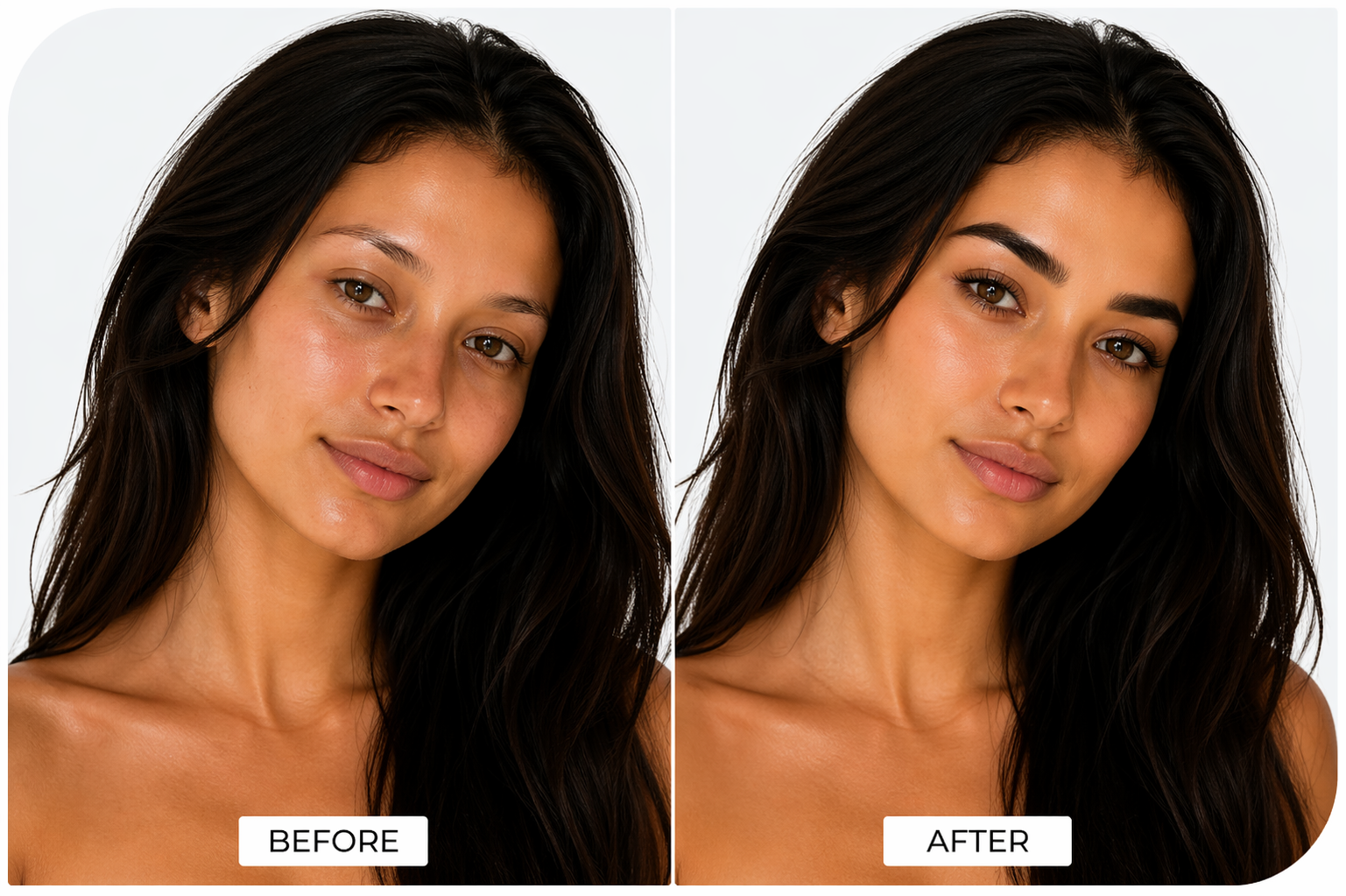 Eyebrow Transplant Before and After — ReGrow Medical